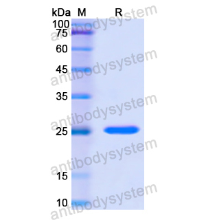 Recombinant Human RCVRN, N-His
