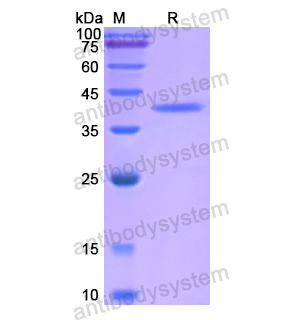 Recombinant Human RORA, N-SUMO