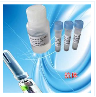 羧肽酶X(M14家族2)抗体