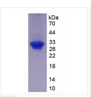 二肽基肽酶8(DPP8)重组蛋白
