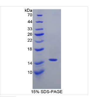 轻肽神经丝蛋白(NEFL)重组蛋白