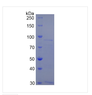 甲硫氨酰氨肽酶2(METAP2)重组蛋白