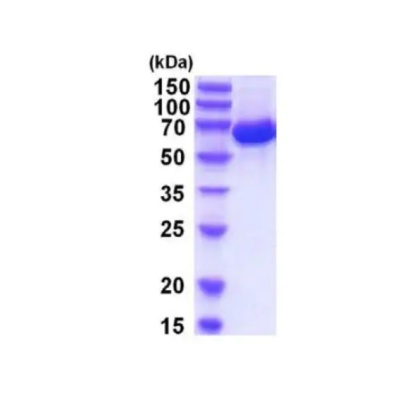 NebuSelect?重组人白蛋白