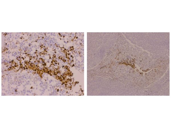 aladdin 阿拉丁 Ab007148 Recombinant CD63 Antibody Recombinant (EPR5702); Rabbit anti Human CD63 Antibody; WB, IHC; Unconjugated