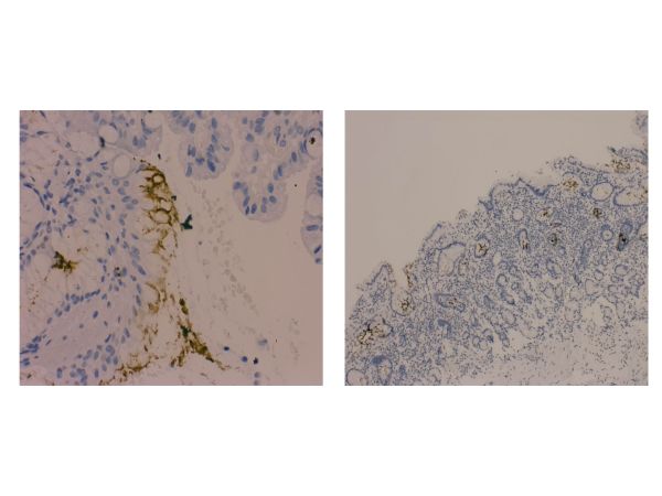 aladdin 阿拉丁 Ab008250 Recombinant Helicobacter pylori Antibody Recombinant (EPR10353); Rabbit anti Helicobacter pylori Antibody; IHC; Unconjugated
