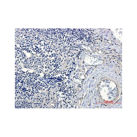 aladdin 阿拉丁 Ab086584 Recombinant 14-3-3 alpha/beta Antibody Recombinant (R08-4A7); Rabbit anti Human 14-3-3 alpha/beta Antibody; WB, IHC; Unconjugated