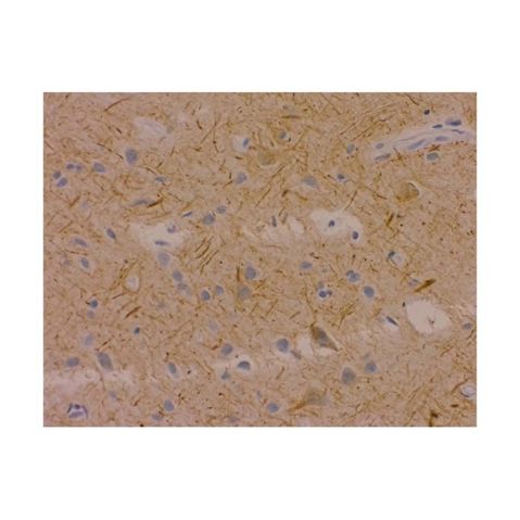 aladdin 阿拉丁 Ab086655 Recombinant Neurofilament-M Antibody Recombinant (EPR23510-76); Rabbit anti Human Neurofilament-M Antibody; IHC, Flow, WB, IP, ELISA, ICC, IF; Unconjugated