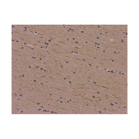 aladdin 阿拉丁 Ab086655 Recombinant Neurofilament-M Antibody Recombinant (EPR23510-76); Rabbit anti Human Neurofilament-M Antibody; IHC, Flow, WB, IP, ELISA, ICC, IF; Unconjugated