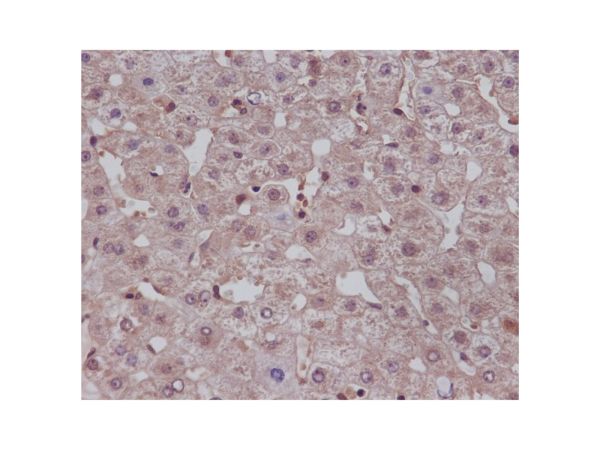 aladdin 阿拉丁 Ab087287 NOTCH1 Antibody pAb; Rabbit anti Human NOTCH1 Antibody; WB, IHC, ICC, IF; Unconjugated