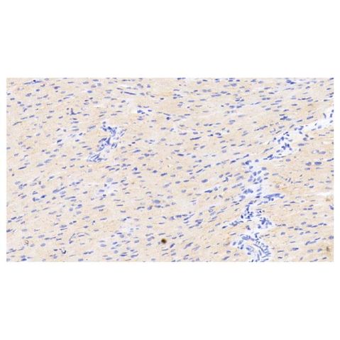 aladdin 阿拉丁 Ab087546 ADIPOQ Mouse mAb mAb (H2); Mouse anti Human ADIPOQ Antibody; WB, IHC; Unconjugated