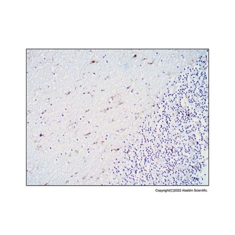 aladdin 阿拉丁 Ab088039 ALDH1A1 Mouse mAb mAb (5A11); Mouse anti Human ALDH1A1 antibody; WB, IHC, ELISA; Unconjugated