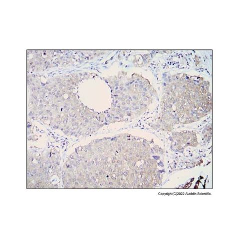 aladdin 阿拉丁 Ab088039 ALDH1A1 Mouse mAb mAb (5A11); Mouse anti Human ALDH1A1 antibody; WB, IHC, ELISA; Unconjugated