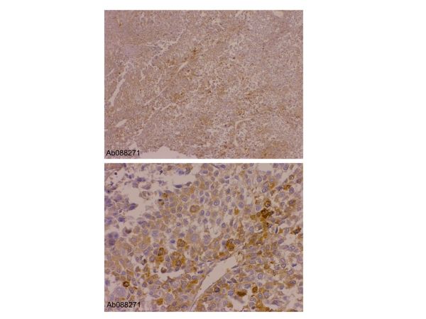 aladdin 阿拉丁 Ab088271 Recombinant alpha 1 Fetoprotein Antibody Recombinant (RM1011), Recombinant Anti-alpha 1 Fetoprotein Antibody; IHC, IF/ICC, Flow, WB, IP, ELISA; Unconjugated