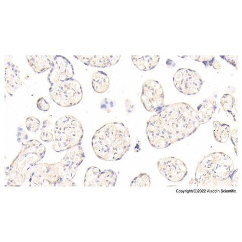 aladdin 阿拉丁 Ab088801 ANGPT2 Antibody pAb; Rabbit anti Human ANGPT2 Antibody; WB, IHC; Unconjugated