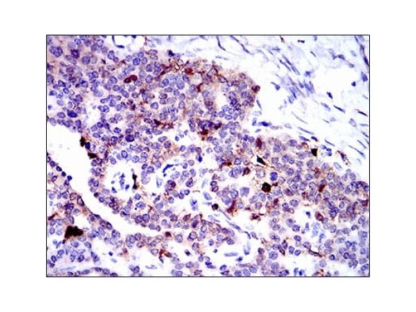 aladdin 阿拉丁 Ab088935 Annexin A1/ANXA1 Mouse mAb mAb (2F1); Mouse anti Human Annexin A1/ANXA1 Antibody; ELISA, WB, IHC; Unconjugated