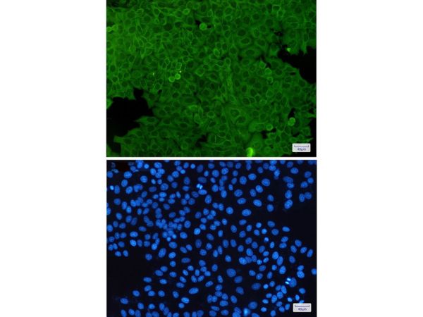 aladdin 阿拉丁 Ab088973 Recombinant ANXA2 Antibody Recombinant (R09-5C1); Rabbit anti Human ANXA2 Antibody; WB, ICC, IF; Unconjugated