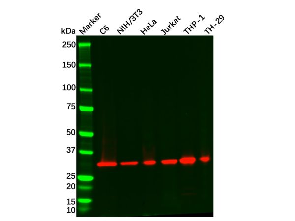 aladdin 阿拉丁 Ab089679 Recombinant ARPC2 Antibody Recombinant (R04-1B6); Rabbit anti Human ARPC2 Antibody; WB, IHC, ICC, IF; Unconjugated