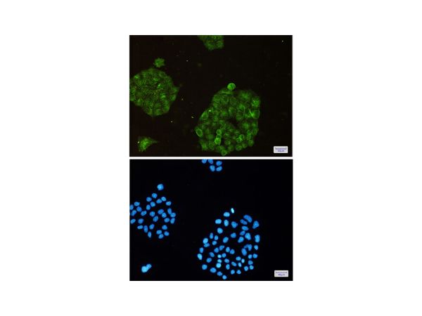 aladdin 阿拉丁 Ab089679 Recombinant ARPC2 Antibody Recombinant (R04-1B6); Rabbit anti Human ARPC2 Antibody; WB, IHC, ICC, IF; Unconjugated