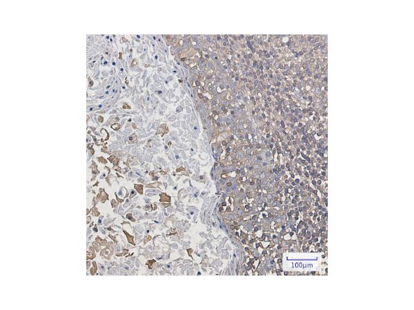 aladdin 阿拉丁 Ab089679 Recombinant ARPC2 Antibody Recombinant (R04-1B6); Rabbit anti Human ARPC2 Antibody; WB, IHC, ICC, IF; Unconjugated