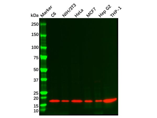 aladdin 阿拉丁 Ab089684 Recombinant ARPC5/p16 ARC Antibody Recombinant (R08-2B3); Rabbit anti Human ARPC5/p16 ARC Antibody; WB, IHC; Unconjugated