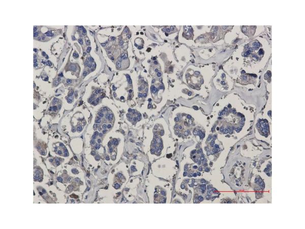 aladdin 阿拉丁 Ab089684 Recombinant ARPC5/p16 ARC Antibody Recombinant (R08-2B3); Rabbit anti Human ARPC5/p16 ARC Antibody; WB, IHC; Unconjugated