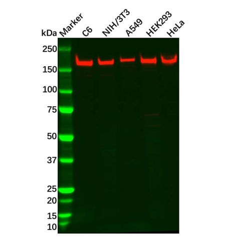 aladdin 阿拉丁 Ab091635 BRCA1 Antibody pAb; Rabbit anti Human BRCA1 Antibody; WB; Unconjugated
