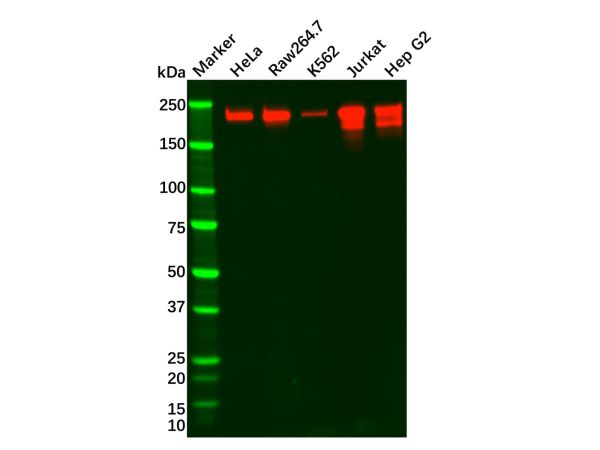 aladdin 阿拉丁 Ab091716 BRG1 Mouse mAb mAb (6D7-F7-B6); Mouse anti Human BRG1 Antibody; WB, ICC, IF, IP; Unconjugated