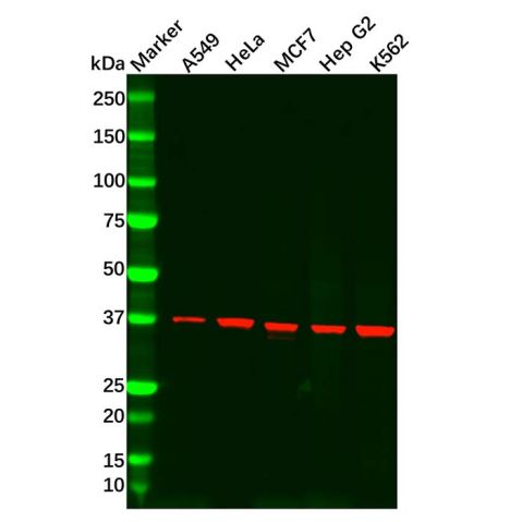 aladdin 阿拉丁 Ab092323 Recombinant CAB39/MO25 Antibody Recombinant (R03-4G7); Rabbit anti Human CAB39 Antibody; WB, IHC; Unconjugated