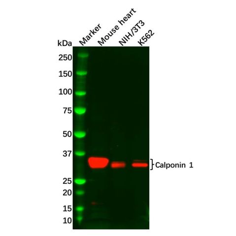 aladdin 阿拉丁 Ab092561 Calponin 1 Antibody pAb; Rabbit anti Human Calponin 1 Antibody; WB, IHC; Unconjugated
