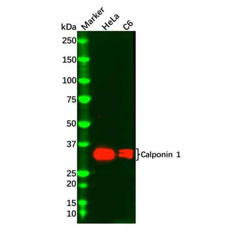 aladdin 阿拉丁 Ab092561 Calponin 1 Antibody pAb; Rabbit anti Human Calponin 1 Antibody; WB, IHC; Unconjugated