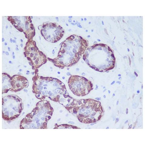 aladdin 阿拉丁 Ab092561 Calponin 1 Antibody pAb; Rabbit anti Human Calponin 1 Antibody; WB, IHC; Unconjugated