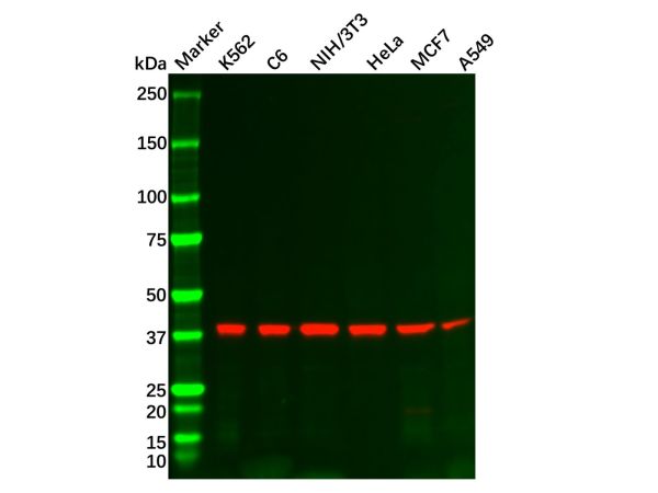 aladdin 阿拉丁 Ab092682 Recombinant PRKACA Antibody Recombinant (R07-8H3); Rabbit anti Human cAMP Protein Kinase Catalytic subunit Antibody; WB, IHC, ICC, IF; Unconjugated