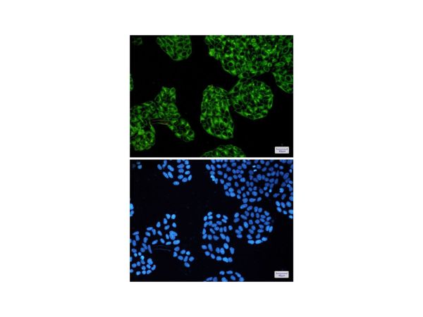 aladdin 阿拉丁 Ab092682 Recombinant PRKACA Antibody Recombinant (R07-8H3); Rabbit anti Human cAMP Protein Kinase Catalytic subunit Antibody; WB, IHC, ICC, IF; Unconjugated