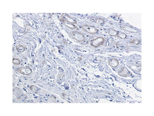 aladdin 阿拉丁 Ab092682 Recombinant PRKACA Antibody Recombinant (R07-8H3); Rabbit anti Human cAMP Protein Kinase Catalytic subunit Antibody; WB, IHC, ICC, IF; Unconjugated