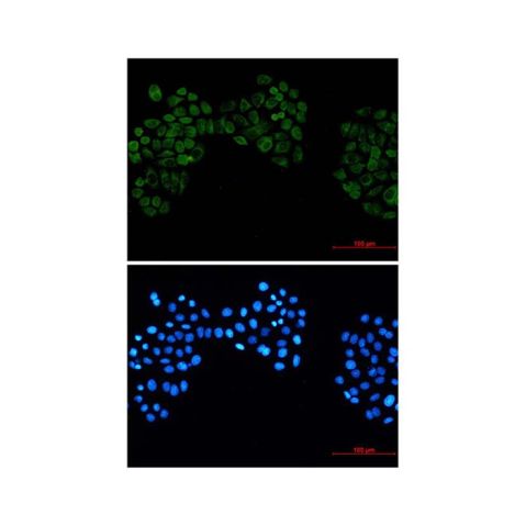 aladdin 阿拉丁 Ab092961 Recombinant Casein Kinase 2 beta Antibody Recombinant (R01-5D5); Rabbit anti Human Casein Kinase 2 beta Antibody; WB, IHC, IF, ICC; Unconjugated