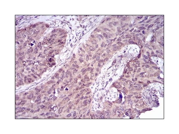 aladdin 阿拉丁 Ab093049 Caspase-7 Mouse mAb mAb (4D10B2); Mouse anti Human Caspase-7 Antibody; WB, IHC, Flow, ELISA; Unconjugated