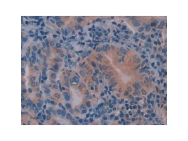 aladdin 阿拉丁 Ab093242 Caveolin-1 Antibody pAb; Rabbit anti Human Caveolin-1 Antibody; WB, IHC; Unconjugated