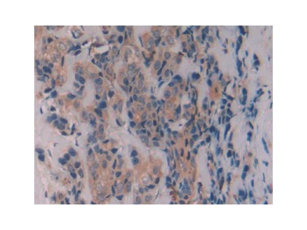 aladdin 阿拉丁 Ab093242 Caveolin-1 Antibody pAb; Rabbit anti Human Caveolin-1 Antibody; WB, IHC; Unconjugated