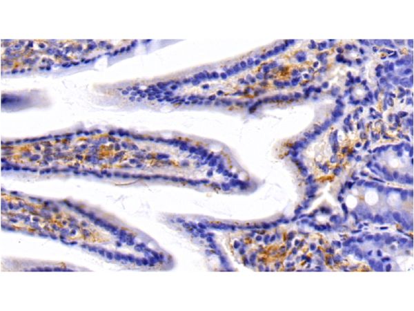 aladdin 阿拉丁 Ab093242 Caveolin-1 Antibody pAb; Rabbit anti Human Caveolin-1 Antibody; WB, IHC; Unconjugated