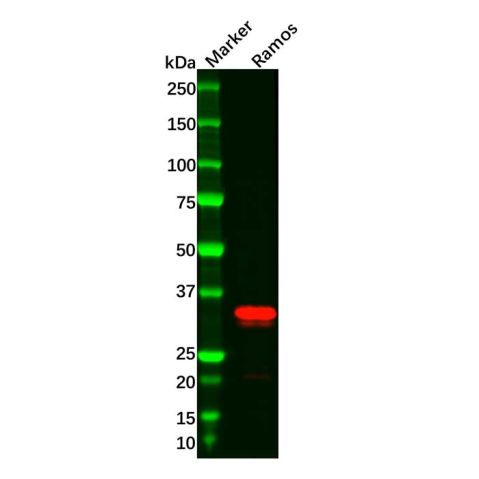 aladdin 阿拉丁 Ab094177 Recombinant CD20 Antibody Recombinant (R04-6H2); Rabbit anti Human CD20 Antibody; WB, IHC; Unconjugated