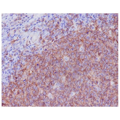aladdin 阿拉丁 Ab094177 Recombinant CD20 Antibody Recombinant (R04-6H2); Rabbit anti Human CD20 Antibody; WB, IHC; Unconjugated