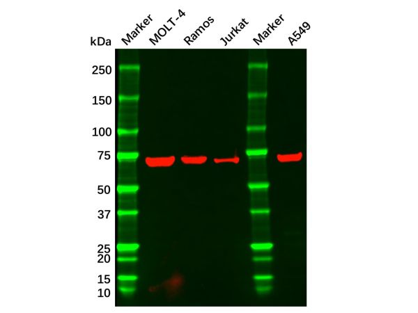 aladdin 阿拉丁 Ab094818 CD42b Mouse mAb mAb (6H6H10); Mouse anti Human CD42b Antibody; WB, Flow, ELISA; Unconjugated