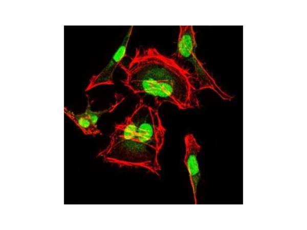 aladdin 阿拉丁 Ab095749 CDK2 Mouse mAb mAb(1A6); Mouse anti human CDK2 antibody; WB, IHC, ICC/IF, Flow, ELISA; Unconjugated