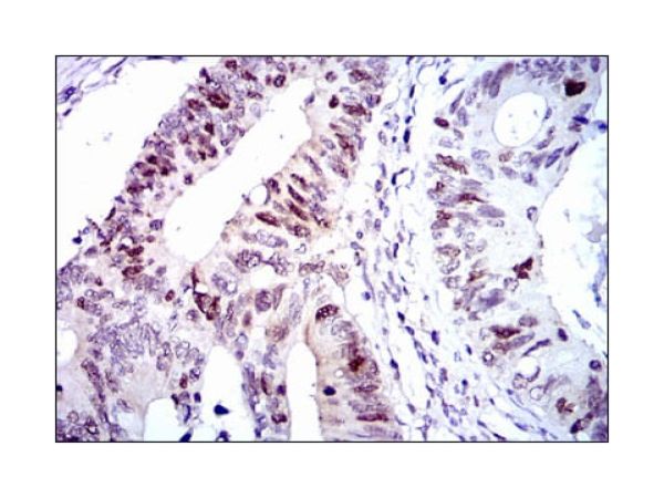 aladdin 阿拉丁 Ab095749 CDK2 Mouse mAb mAb(1A6); Mouse anti human CDK2 antibody; WB, IHC, ICC/IF, Flow, ELISA; Unconjugated