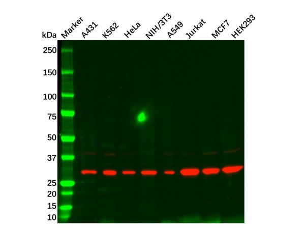 aladdin 阿拉丁 Ab095769 CDK5 Mouse mAb mAb(1552CT262.105.8); Mouse anti human CDK5 A ntibody; WB, IHC, Flow, IF, ICC; Unconjugated