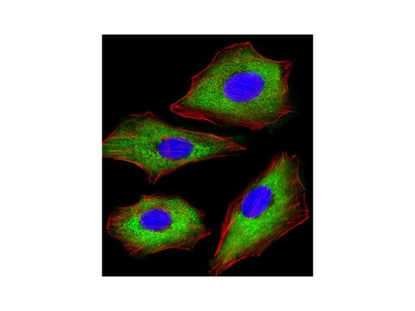 aladdin 阿拉丁 Ab095769 CDK5 Mouse mAb mAb(1552CT262.105.8); Mouse anti human CDK5 A ntibody; WB, IHC, Flow, IF, ICC; Unconjugated