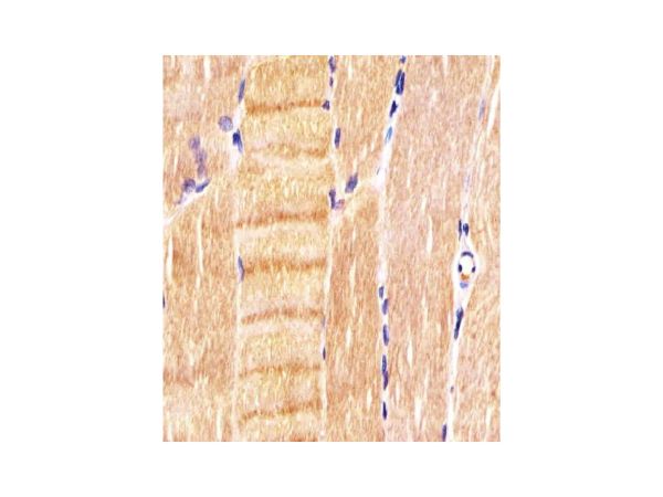 aladdin 阿拉丁 Ab095769 CDK5 Mouse mAb mAb(1552CT262.105.8); Mouse anti human CDK5 A ntibody; WB, IHC, Flow, IF, ICC; Unconjugated