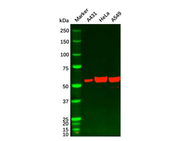 aladdin 阿拉丁 Ab096310 Chk1 Mouse mAb mAb(2G1D5); Mouse anti Human Chk1 Antibody; WB, ELISA; Unconjugated