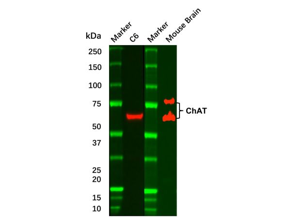 aladdin 阿拉丁 Ab096389 Recombinant Choline Acetyltransferase Antibody Recombinant(R07-1G8); Rabbit anti Human Choline Acetyltransferase  Antibody; WB, ICC, IF; Unconjugated