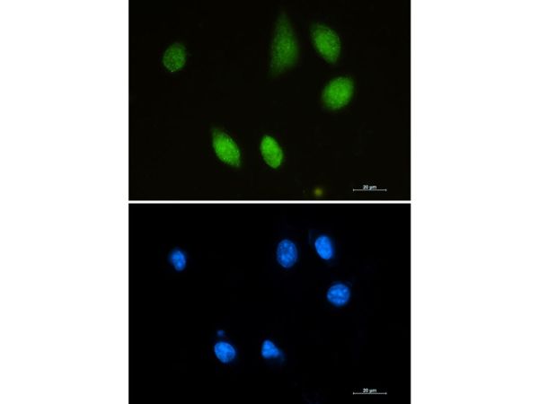 aladdin 阿拉丁 Ab096389 Recombinant Choline Acetyltransferase Antibody Recombinant(R07-1G8); Rabbit anti Human Choline Acetyltransferase  Antibody; WB, ICC, IF; Unconjugated